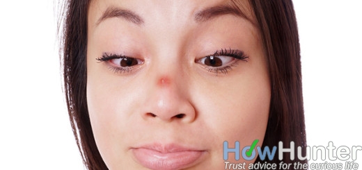 10 ways to get rid of whiteheads on nose and chin fast naturally