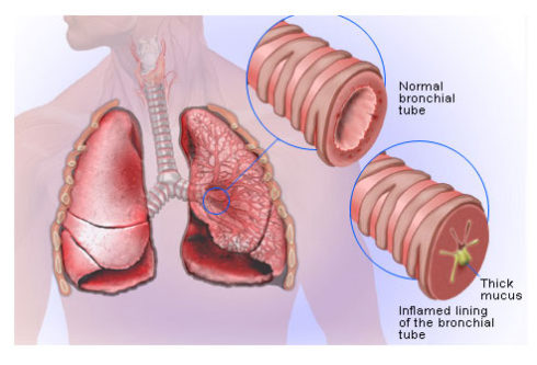 mucus in lungs