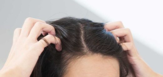 get rid of dry scalp
