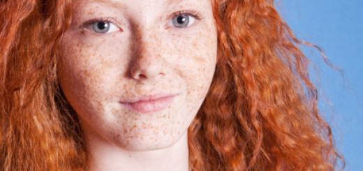 Get Rid Of Freckles On Face