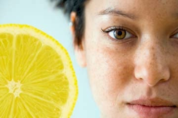 lemon for freckles
