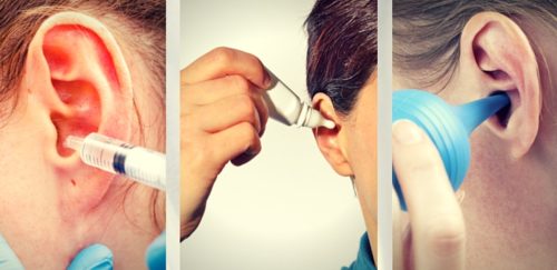 ear wax removal