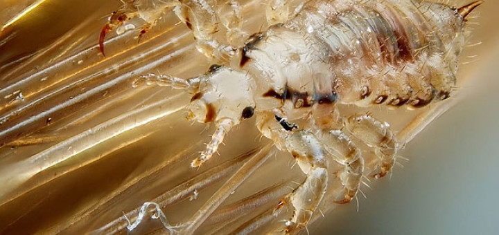 head lice pictures home remedy