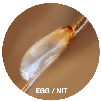 lice eggs pictures