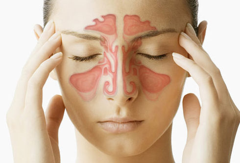 sinus congestion pictures