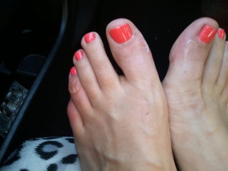 blisters on feet